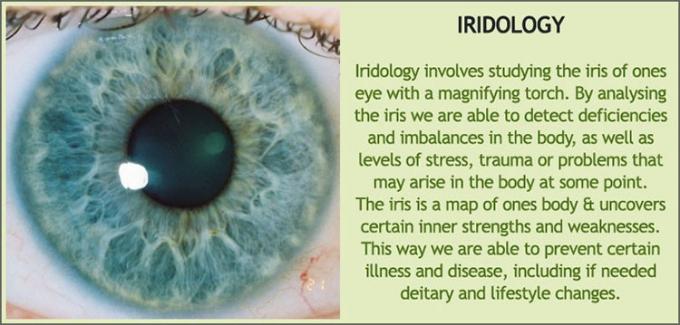 iridology iris diagnosis