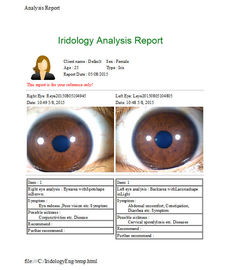 Green Iris Recognition Camera Iridology Device الإنجليزية الإسبانية الصينية