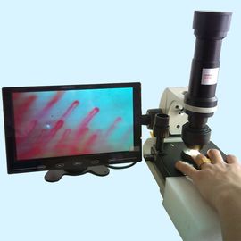 مستشفى Nailfold شعري مجهر / Microcirculation Microscope متعددة الوظائف الطبية