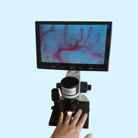 شاشة LCD اللون آلة اختبار دوران الأوعية الدقيقة مستشفى السريرية الرئيسية